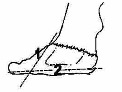 T?rnak taban?nda yap?lan kesimde izlenecek s?ra